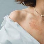 Panduan Memilih Perhiasan Perak untuk Kulit Sensitif